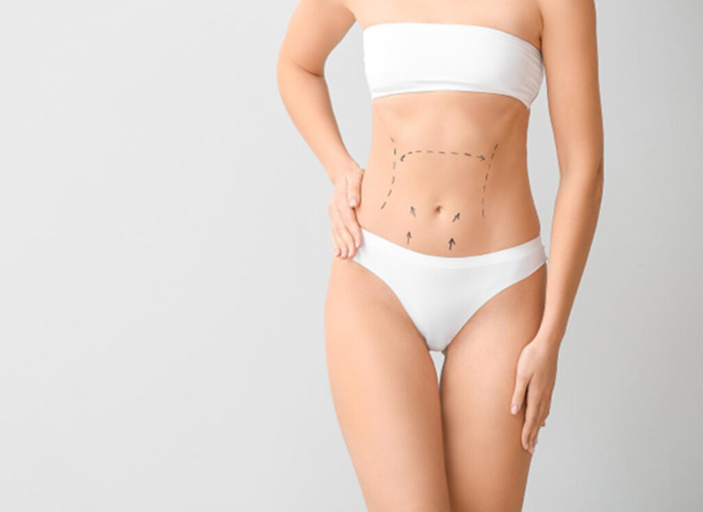 Abdominoplastie complète et mini abdominoplastie les avanatages