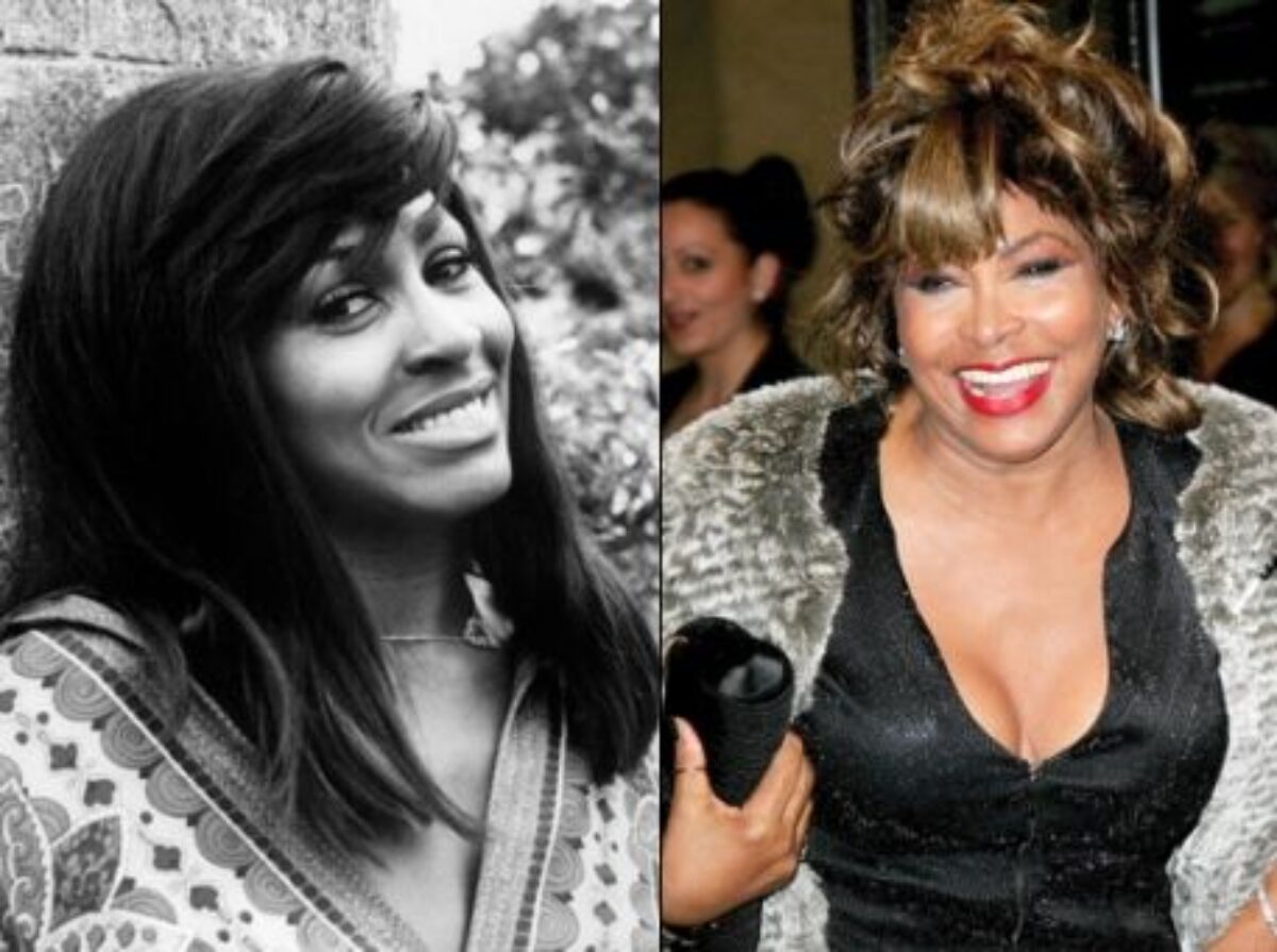 Tina Turner : retour sur sa vie tourmentée et ses chirurgies plastiques